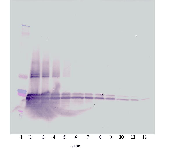 TNFRSF13B / TACI Antibody