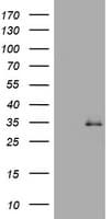 TGIF1 Antibody (clone OTI1H3)