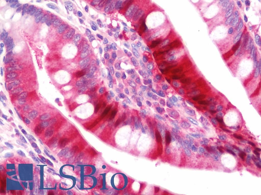 IHC-plus™ I-BABP / FABP6 Antibody (aa1-142)