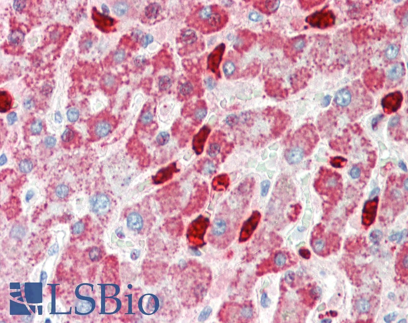 Polyclonal Rabbit anti-Human CYP3A43 Antibody (aa254-303, IHC, WB)