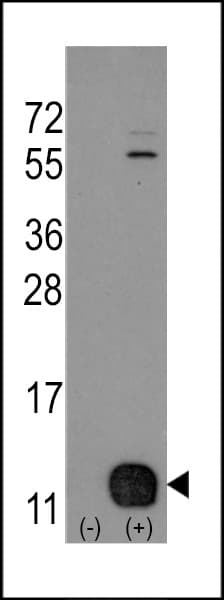 IHC-plus™ PHPT1 Antibody (aa1-30)