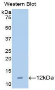 CCL15 / MIP5 Antibody (aa22-113, FITC)