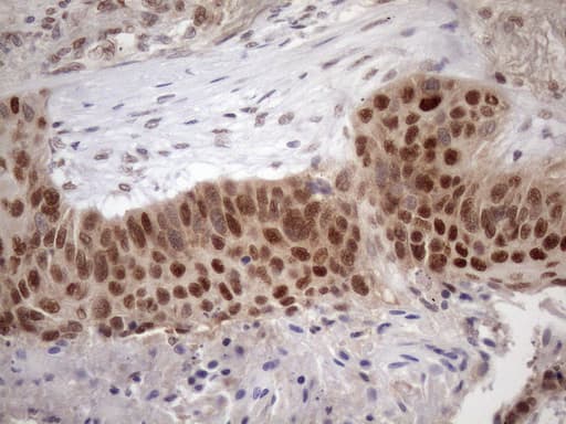 TDG / Thymine DNA Glycosylase Antibody (aa160-253, clone OTI3A12)