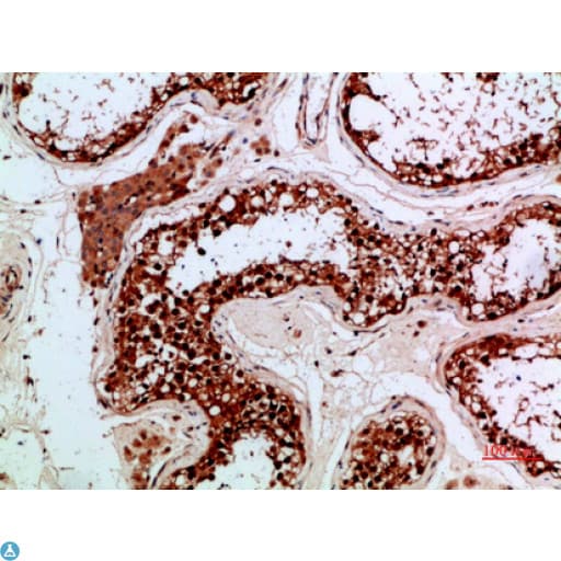 Polyclonal Rabbit anti-Human Proenkephalin / PENK Antibody (WB)