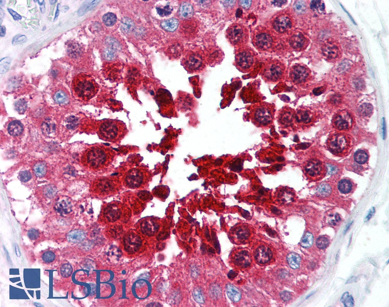 IHC-plus™ TPX2 Antibody (clone 18D5)