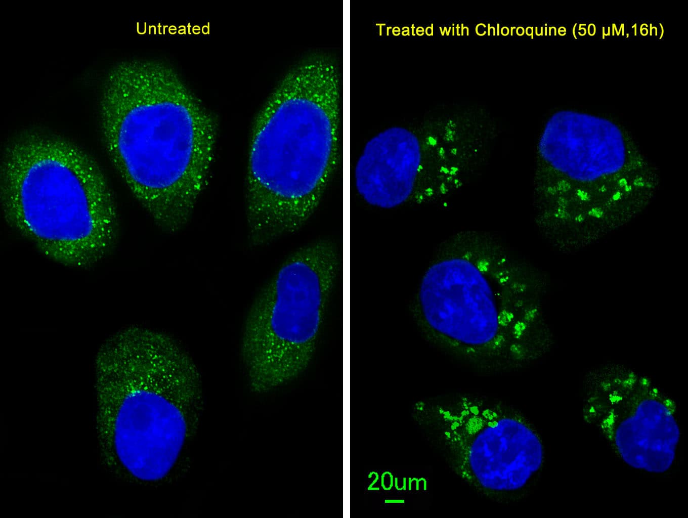 Polyclonal Rabbit anti-Human MAP1LC3B / LC3B Antibody (aa1-30, IHC, IF, WB)