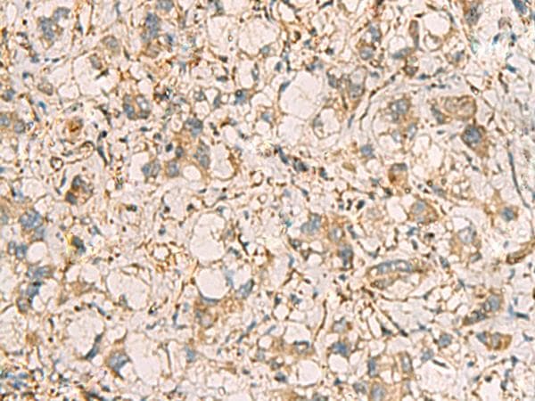 Polyclonal Rabbit anti-Human PRKRA / PACT Antibody (IHC)