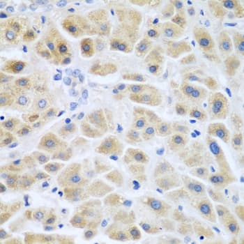 ACCS / ACS Antibody