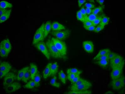 SLC26A2 Antibody
