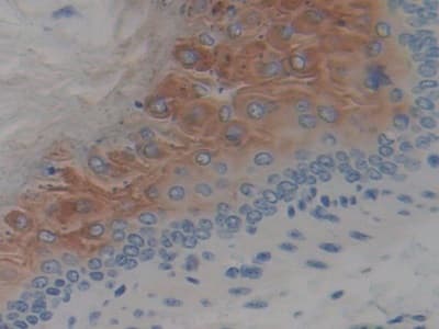 SPINK5 / LEKTI Antibody (aa734-995)