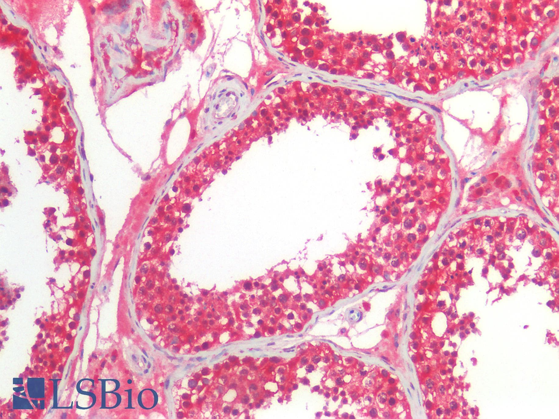PGD Antibody (clone AT46B3)