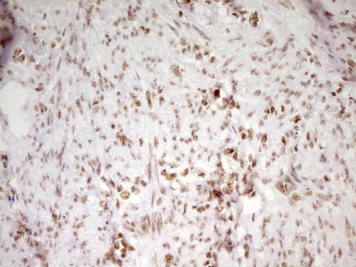 Monoclonal Mouse anti-Human SP110 Antibody (clone OTI4C1, aa232-521, IHC, WB)