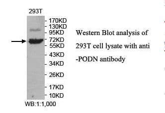 Polyclonal Rabbit anti-Human PODN Antibody (aa69-236, IHC, WB)