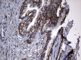 PIK3CD / PI3K Delta Antibody (aa286-610, clone OTI2H3)