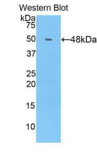 COL14A1 / Collagen XIV Antibody (aa1280-1461, PE)