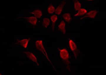 IKBKB / IKK2 / IKK Beta Antibody (phospho-Tyr188)