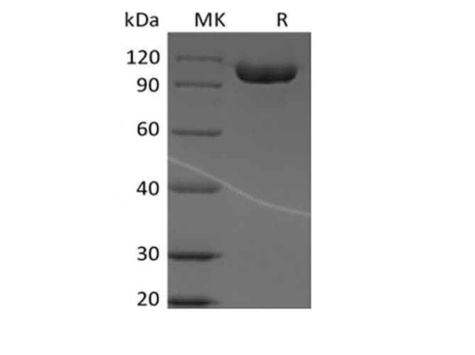 Human CD316 / IGSF8 Protein (Recombinant Fc, C-terminus)