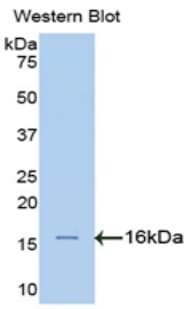 SPTAN1 / Alpha Fodrin Antibody (aa922-1043)