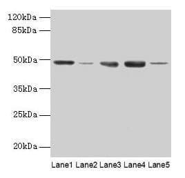 Polyclonal Rabbit anti-Human FNTB Antibody