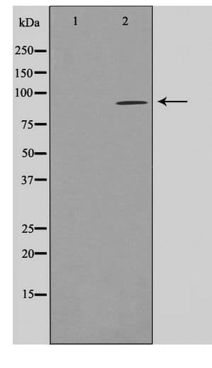 Polyclonal Rabbit anti-Human AKAP2 Antibody (WB)