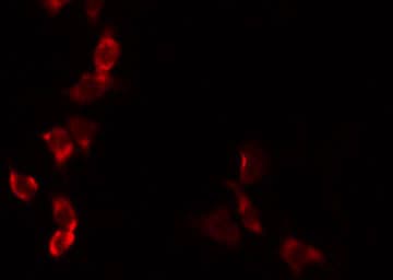 Polyclonal Rabbit anti-Human ADCK3 / CABC1 Antibody (IF, WB)