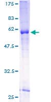 Human WNT7B Protein (Recombinant GST)