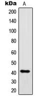 IgG1 Antibody (Internal)