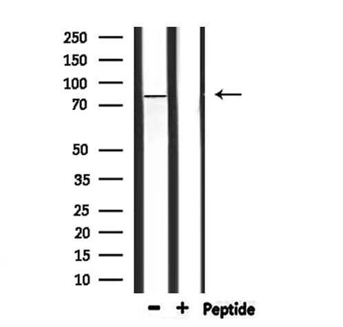 HADHA Antibody