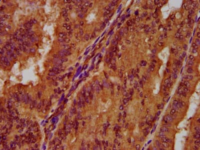 PGLYRP1 / PGRP Antibody