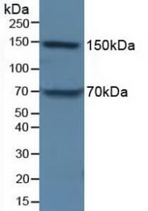 APOB / Apolipoprotein B Antibody (aa3365-3548)