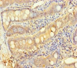 Polyclonal Rabbit anti-Human TESPA1 / KIAA0748 Antibody