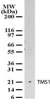 IHC-plus™ Polyclonal Rabbit anti-Human PYCARD / ASC / TMS1 Antibody (aa31-46, IHC, WB)