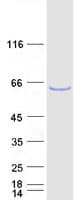 Human EDC3 Protein (Recombinant Myc-DDK (Flag))