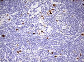 MKI67 / Ki67 Antibody (aa1160-1493, clone OTI18G5)