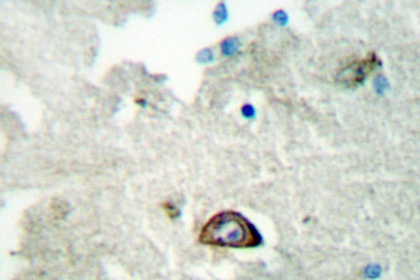 Polyclonal Rabbit anti-Human EFNA3 / Ephrin A3 Antibody (Glu196, IHC, IF, WB)