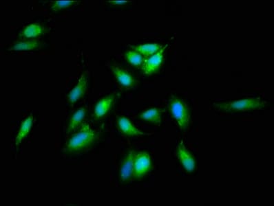 SREBF2 / SREBP2 Antibody