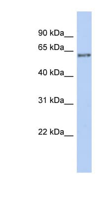 PCCB Antibody (aa395-444)