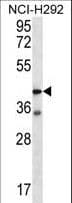 F2RL2 / PAR3 Antibody (aa21-50)