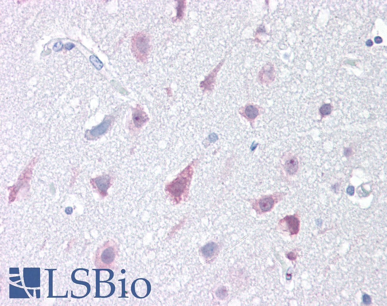 IHC-plus™ NPC / NPC1 Antibody