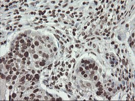 CHN1 Antibody (clone OTI2G6)