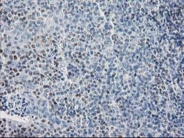 SULT1C2 / Sulfotransferase 1C2 Antibody (clone OTI5A11)