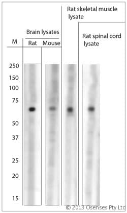 ASIC1 / ACCN2 Antibody (aa460-505)