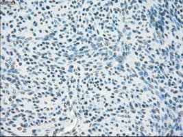 Monoclonal Mouse anti-Human CYPOR / POR Antibody (clone OTI1B11, IHC, IF, WB)