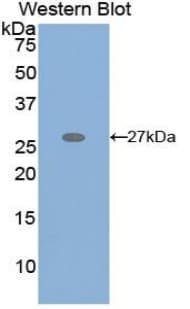 GRIP1 Antibody (aa874-1073)