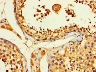 Polyclonal Rabbit anti-Human ACLY / ATP Citrate Lyase Antibody (IHC)