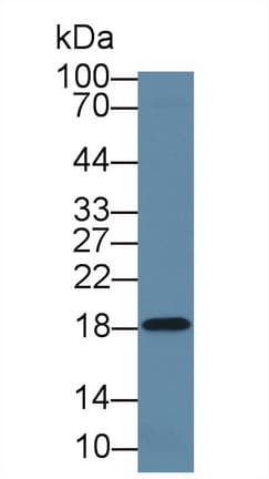 LCN1 / Lipocalin-1 Antibody (aa24-172)