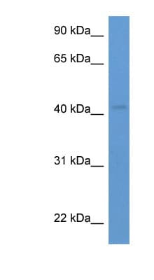 ALX / HSH2D Antibody (aa267-316)