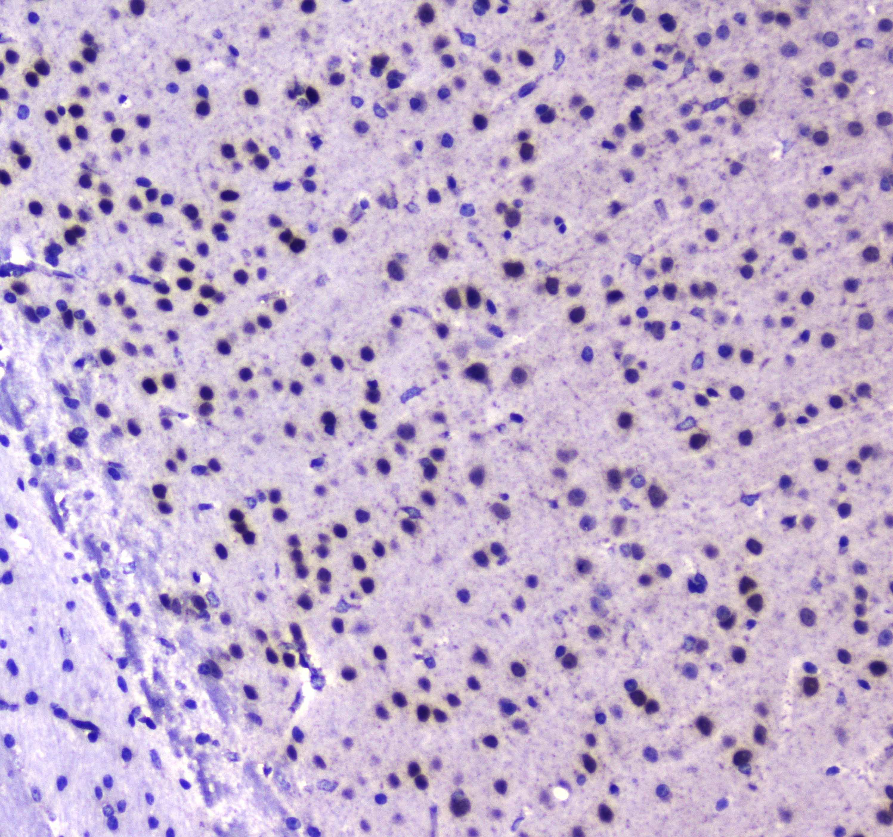 RUNX1T1 / ETO Antibody