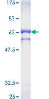 Human PP2CB / PPP2CB Protein (Recombinant GST)