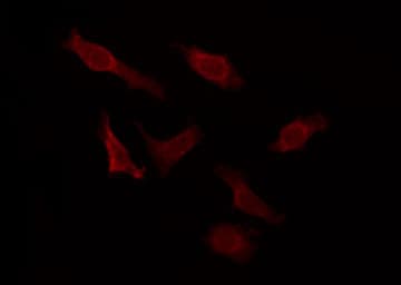 Polyclonal Rabbit anti-Human MCHR2 Antibody (IF, WB)